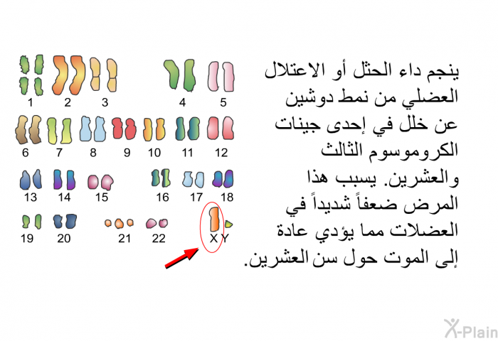 ينجم داء الحثل أو الاعتلال العضلي من نمط دوشين عن خلل في إحدى جينات الكروموسوم الثالث والعشرين. يسبب هذا المرض ضعفاً شديداً في العضلات مما يؤدي عادة إلى الموت حول سن العشرين.