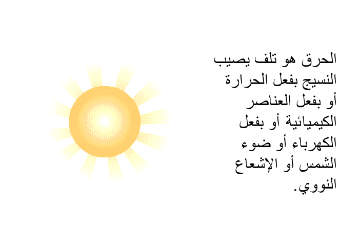 الحرق هو تلف يصيب النسيج بفعل الحرارة أو بفعل العناصر الكيماوية أو بفعل الكهرباء أو ضوء الشمس أو الإشعاع النووي<B>.</B>