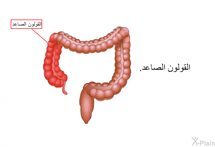 القولون الصاعد.