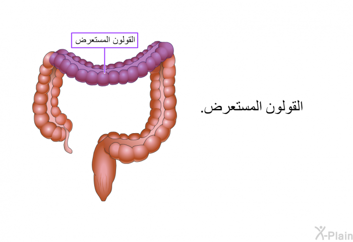 القولون المستعرض.