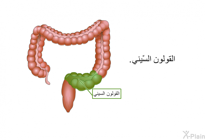 القولون السِّيني.