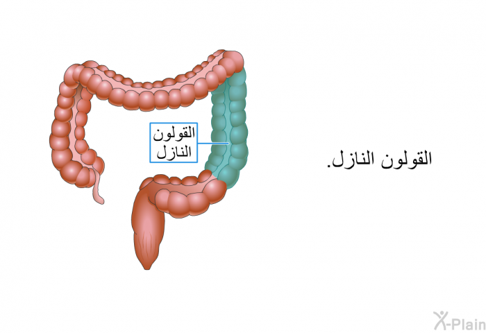 القولون النازل.