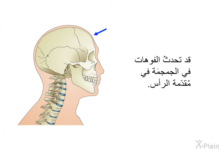 قد تحدثُ الفوهات في الجمجمَة في مُقدّمة الرأس.