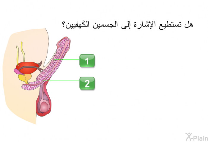 هل تستطيع الإشارة إلى الجسمين الكَهفيين؟