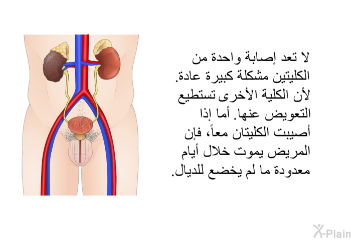 لا تعد إصابة واحدة من الكليتين مشكلة كبيرة عادة. لأن الكلية الأخرى تستطيع التعويض عنها. أما إذا أصيبت الكليتان معاً، فإن المريض يموت خلال أيام معدودة ما لم يخضع للديال.