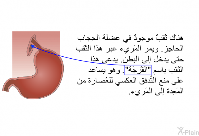 هناك ثقبٌ موجودٌ في عضلة الحِجاب الحاجِز. ويمر المَريء عبر هذا الثقب حتى يدخل إلى البطن. يدعى هذا الثقب باسم "الفُرجَة". وهو يساعد على منع التَّدفق العكسي للعُصارة من المَعِدة إلى المَريء.