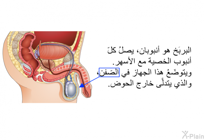 البربَخ هو أنبوبان، يصلُ كلّ أنبوب الخصية مع الأسهر. ويتوضّعُ هذا الجهاز في الصّفن، والذي يتدلَّى خارج الحوض.