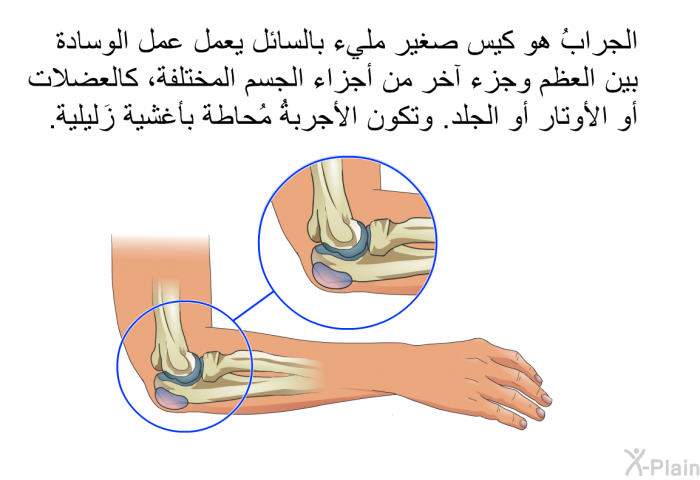 الجرابُ هو كيس صغير مليء بالسائل يعمل عمل الوسادة بين العظم وجزء آخر من أجزاء الجسم المختلفة، كالعضلات أو الأوتار أو الجلد. وتكون الأجربةُ مُحاطة بأغشية زَليلية.