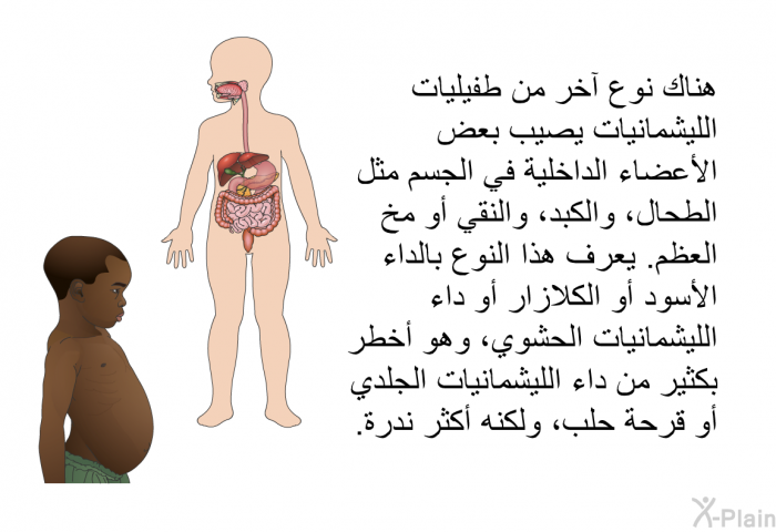 هناك نوع آخر من طفيليات الليشمانيات يصيب بعض الأعضاء الداخلية في الجسم مثل الطحال، والكبد، والنقي أو مخ العظم. يعرف هذا النوع بالداء الأسود أو الكلازار أو داء الليشمانيات الحشوي، وهو أخطر بكثير من داء الليشمانيات الجلدي أو قرحة حلب، ولكنه أكثر ندرة.