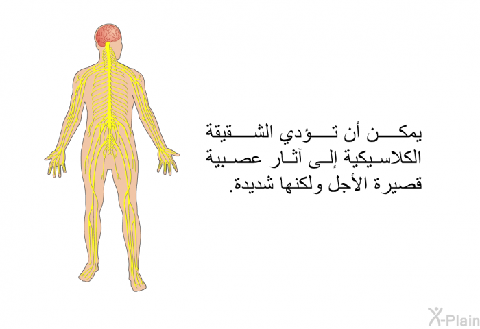 يمكن أن تؤدي الشقيقة الكلاسيكية إلى آثار عصبية قصيرة الأجل ولكنها شديدة.