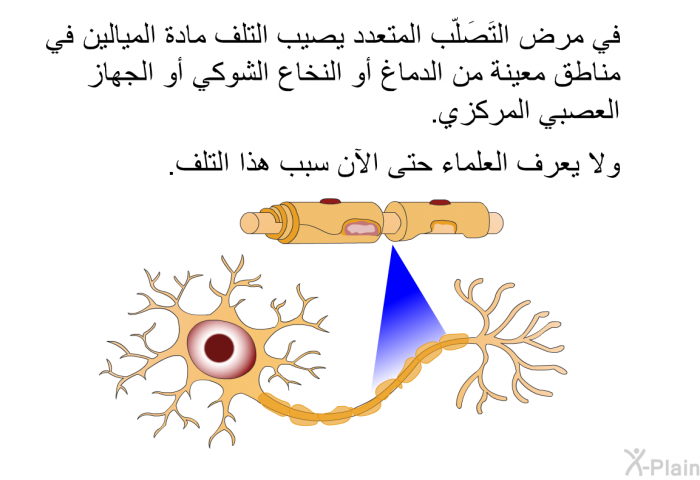 في مرض التَصَلّب المتعدد يصيب التلف مادة الميالين في مناطق معينة من الدماغ أو النخاع الشوكي أو الجهاز العصبي المركزي. ولا يعرف العلماء حتى الآن سبب هذا التلف.