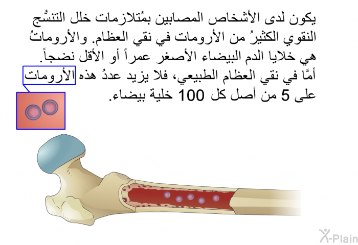 يكون لدى الأشخاص المصابين بمُتلازمات خلل التنسُّج النقوي الكثيرُ من الأرومات في نقي العظام. والأروماتُ هي خلايا الدم البيضاء الأصغر عمراً أو الأقل نضجاً. أمَّا في نقي العظام الطبيعي، فلا يزيد عددُ هذه الأرومات على 5 من أصل كل 100 خلية بيضاء.