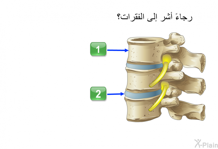 رجاءً أشر إلى الفقرات؟