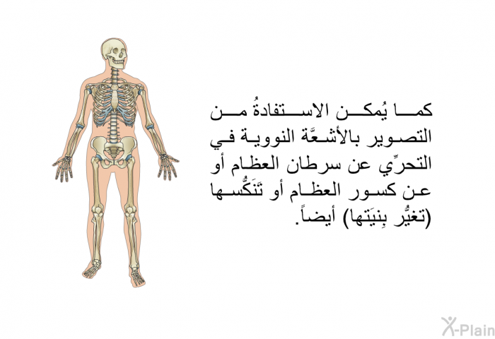 كما يُمكن الاستفادةُ من التصوير بالأشعَّة النووية في التحرِّي عن سرطان العظام أو عن كسور العظام أو تَنَكُّسها (تغيُّر بِنيَتها) أيضاً.