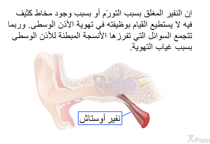 إن النفير المغلق بسبب التورّم أو بسبب وجود مخاط كثيف فيه لا يستطيع القيام بوظيفته في تهوية الأذن الوسطى. وربما تتجمع السوائل التي تفرزها الأنسجة المبطنة للأذن الوسطى بسبب غياب التهوية.