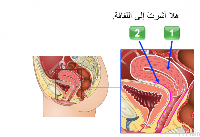 هلا أشرتَ إلى اللفافة.