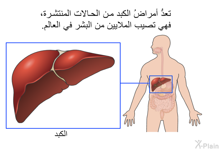 تعدُّ أمراضُ الكبد من الحالات المنتشرة، فهي تصيب الملايين من البشر في العالم.