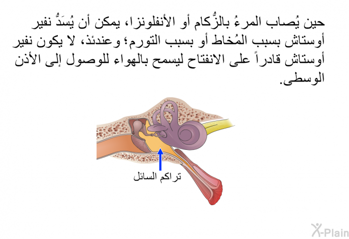 حين يُصاب المرءُ بالزُّكام أو الأنفلونزا، يمكن أن يُسَدُّ نفير أوستاش بسبب المُخاط أو بسبب التورم؛ وعندئذ، لا يكون نفير أوستاش قادراً على الانفتاح ليسمح بالهواء للوصول إلى الأذن الوسطى.