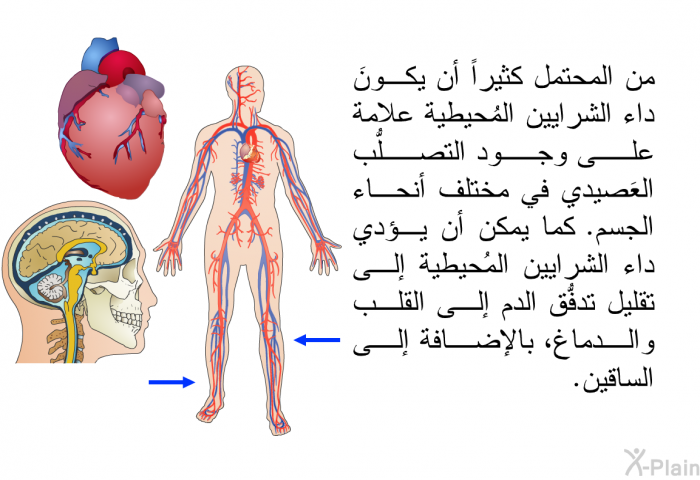 تسبب تيارات الحمل الهابطة إلى سحب الصفيحة المحيطية إلى أعلى