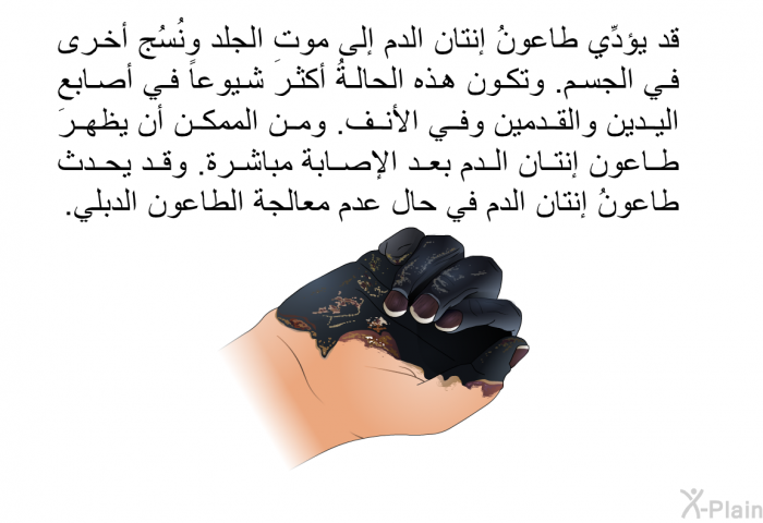 قد يؤدِّي طاعونُ إنتان الدم إلى موت الجلد ونُسُج أخرى في الجسم. وتكون هذه الحالةُ أكثرَ شيوعاً في أصابع اليدين والقدمين وفي الأنف. ومن الممكن أن يظهرَ طاعون إنتان الدم بعد الإصابة مباشرة. وقد يحدث طاعونُ إنتان الدم في حال عدم معالجة الطاعون الدبلي.