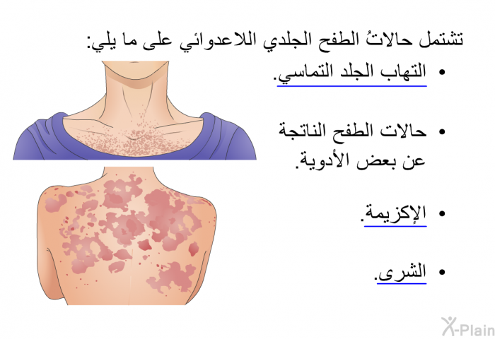 تشتمل حالاتُ الطفح الجلدي اللاعدوائي على ما يلي:  التهاب الجلد التماسي. حالات الطفح الناتجة عن بعض الأدوية. الإكزيمة. الشرى.