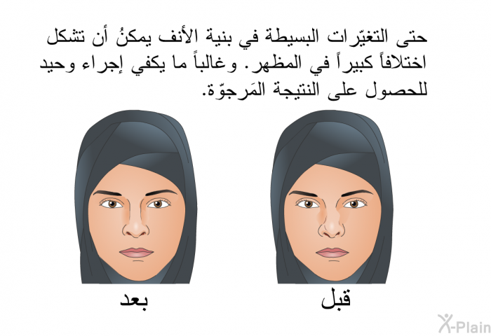 حتى التغيّرات البسيطة في بنية الأنف يمكنُ أن تشكل اختلافاً كبيراً في المظهر. وغالباً ما يكفي إجراء وحيد للحصول على النتيجة المَرجوّة.