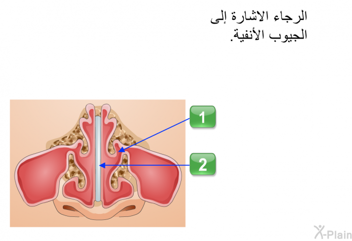 الرجاء الاشارة إلى الجيوب الأنفية.