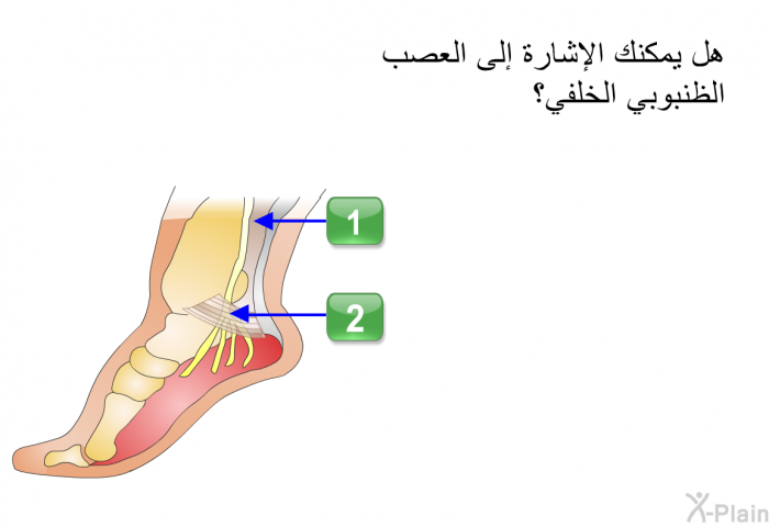 هل يمكنك الإشارة إلى العصب الظنبوبي الخلفي؟