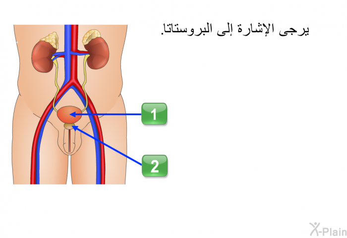 يرجى الإشارة إلى البروستاتا.