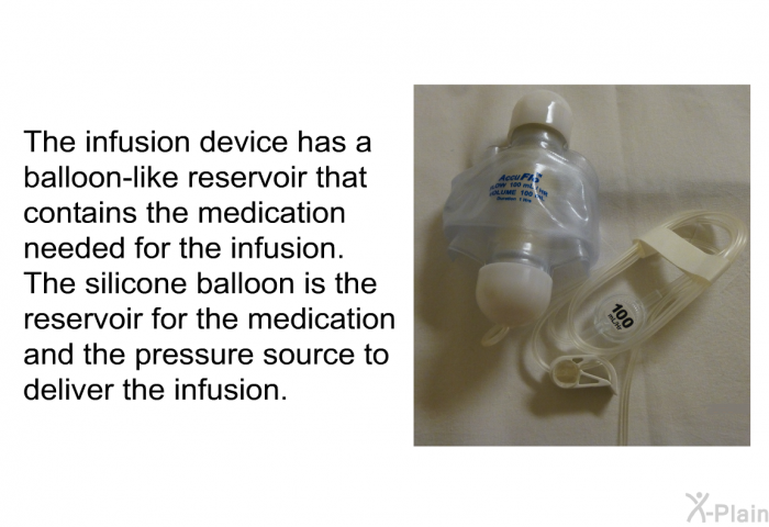 The infusion device has a balloon-like reservoir that contains the medication needed for the infusion. The silicone balloon is the reservoir for the medication and the pressure source to deliver the infusion.