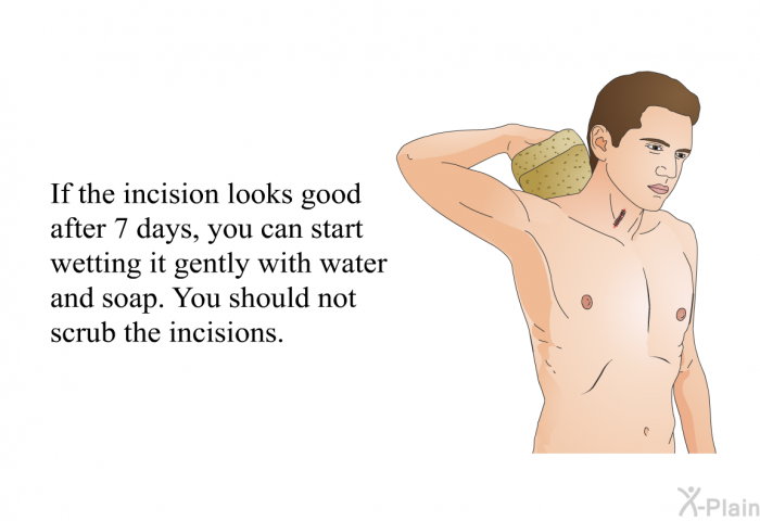 If the incision looks good after 7 days, you can start wetting it gently with water and soap. You should not scrub the incisions.