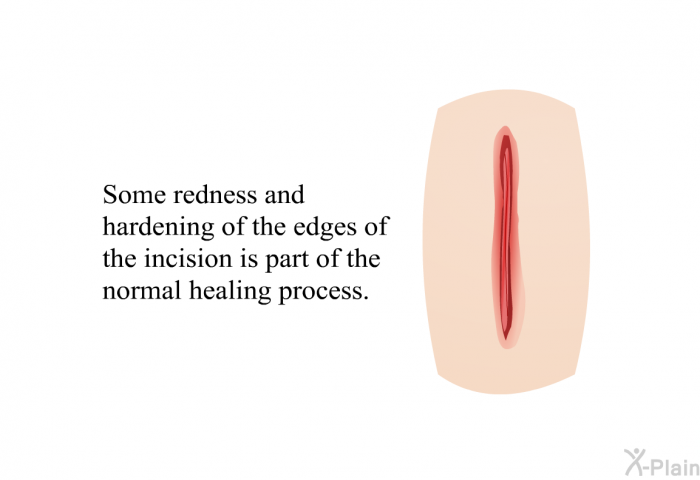 Some redness and hardening of the edges of the incision is part of the normal healing process.