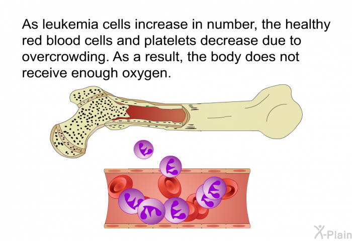 As leukemia cells increase in number, the healthy red blood cells and platelets decrease due to overcrowding. As a result, the body does not receive enough oxygen.