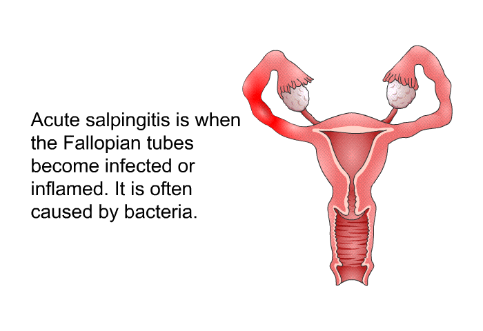 Acute salpingitis is when the Fallopian tubes become infected or inflamed. It is often caused by bacteria.