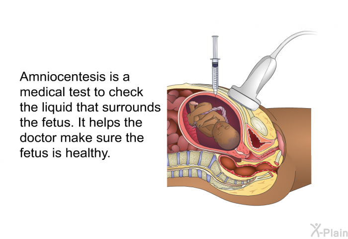 Amniocentesis is a medical test to check the liquid that surrounds the fetus. It helps the doctor make sure the fetus is healthy.