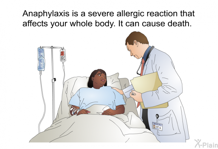 Anaphylaxis is a severe allergic reaction that affects your whole body. It can cause death.