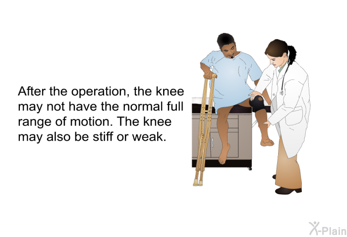 After the operation, the knee may not have the normal full range of motion. The knee may also be stiff or weak.