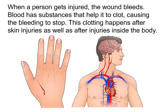 When a person gets injured, the wound bleeds. Blood has substances that help it to clot, causing the bleeding to stop. This clotting happens after skin injuries as well as after injuries inside the body.
