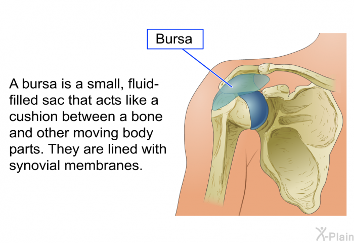 A bursa is a small, fluid-filled sac that acts like a cushion between a bone and other moving body parts. They are lined with synovial membranes.