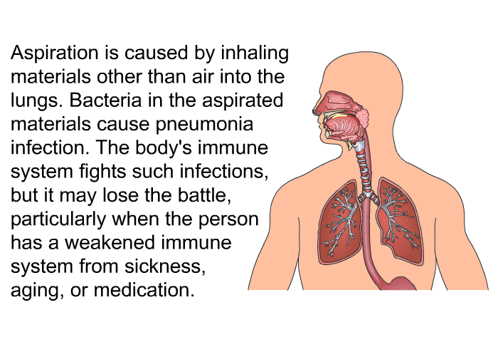 Aspiration is caused by inhaling materials other than air into the lungs. Bacteria in the aspirated materials cause pneumonia infection. The body's immune system fights such infections, but it may lose the battle, particularly when the person has a weakened immune system from sickness, aging, or medication.