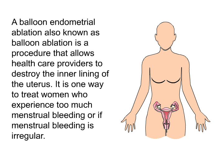 A balloon endometrial ablation also known as balloon ablation is a procedure that allows health care providers to destroy the inner lining of the uterus. It is one way to treat women who experience too much menstrual bleeding or if menstrual bleeding is irregular.