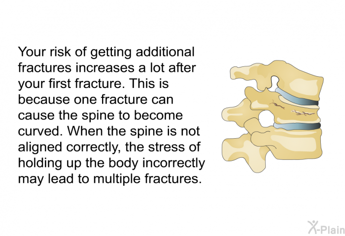 Your risk of getting additional fractures increases a lot after your first fracture. This is because one fracture can cause the spine to become curved. When the spine is not aligned correctly, the stress of holding up the body incorrectly may lead to multiple fractures.