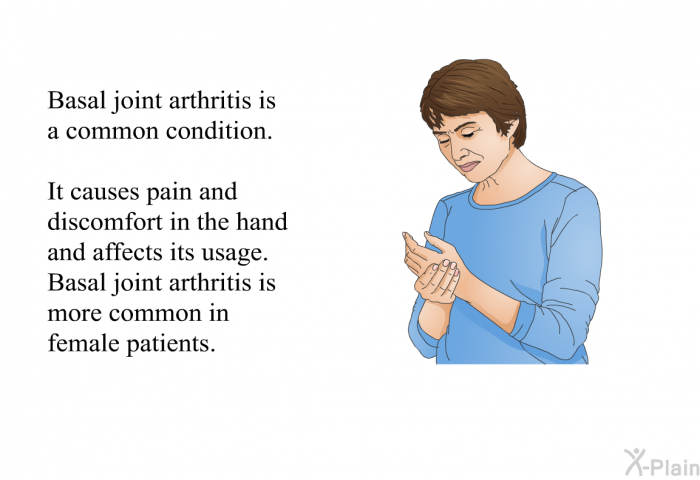 Basal joint arthritis is a common condition. It causes pain and discomfort in the hand and affects its usage. Basal joint arthritis is more common in female patients.