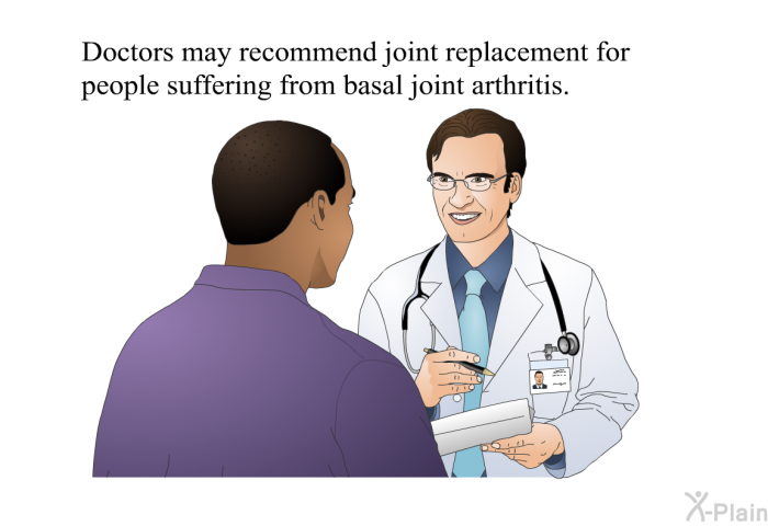 Doctors may recommend joint replacement for people suffering from basal joint arthritis.
