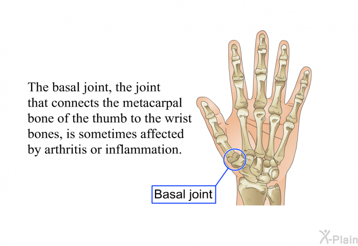 The basal joint, the joint that connects the metacarpal bone of the thumb to the wrist bones, is sometimes affected by arthritis or inflammation.