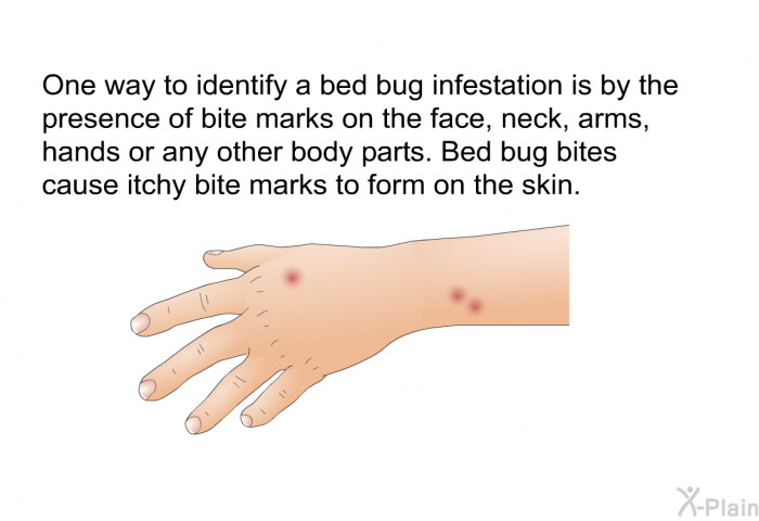 One way to identify a bed bug infestation is by the presence of bite marks on the face, neck, arms, hands or any other body parts. Bed bug bites cause itchy bite marks to form on the skin.