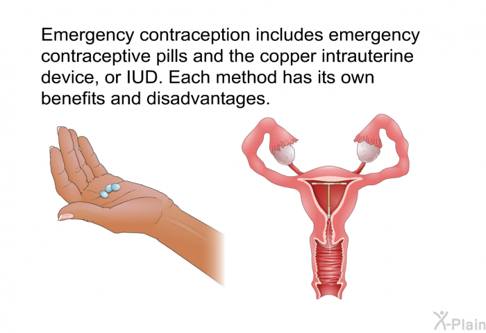 Emergency contraception includes emergency contraceptive pills and the copper intrauterine device, or IUD. Each method has its own benefits and disadvantages.