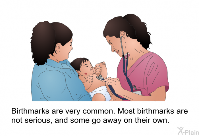 Birthmarks are very common. Most birthmarks are not serious, and some go away on their own.