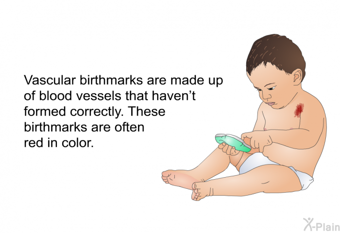 Vascular birthmarks are made up of blood vessels that haven't formed correctly. These birthmarks are often red in color.