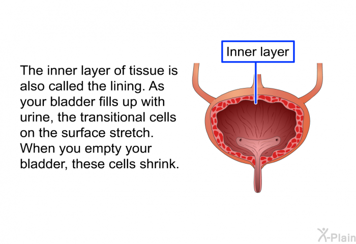 The inner layer of tissue is also called the lining. As your bladder fills up with urine, the transitional cells on the surface stretch. When you empty your bladder, these cells shrink.